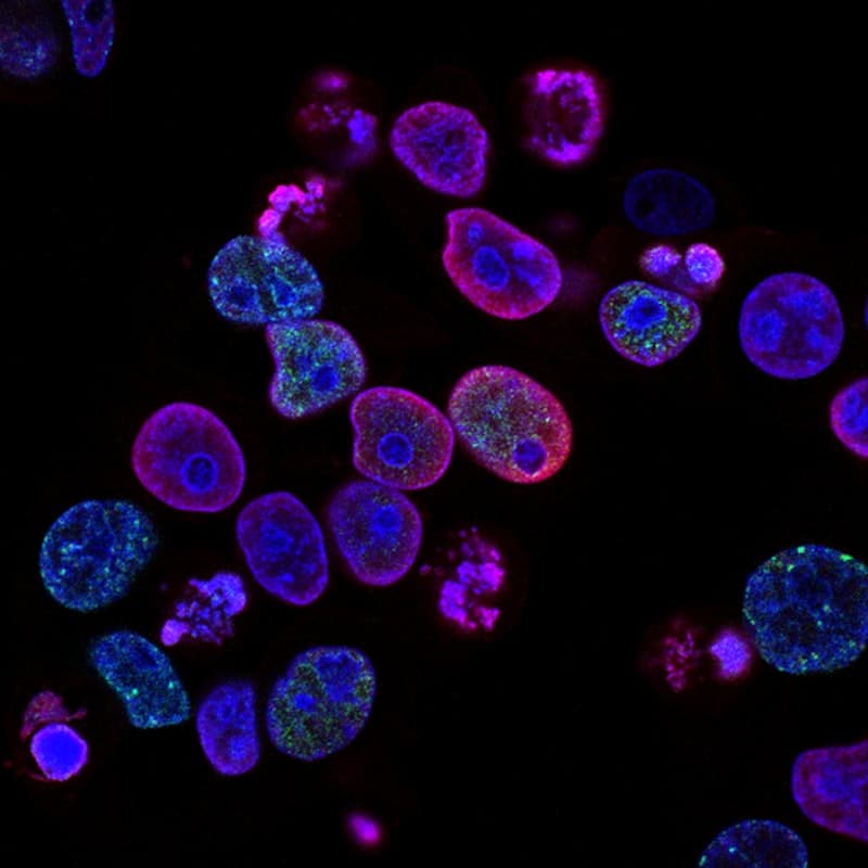 La science derriere la bioresonance: ce que vous devez savoir